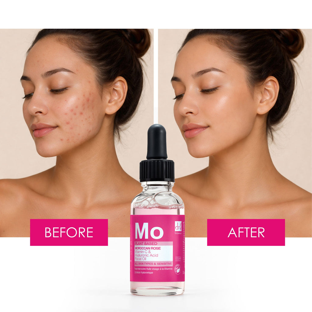 Dr. Botanicals Moroccan Rose Facial Oil – Nourishing Rose Face Oil