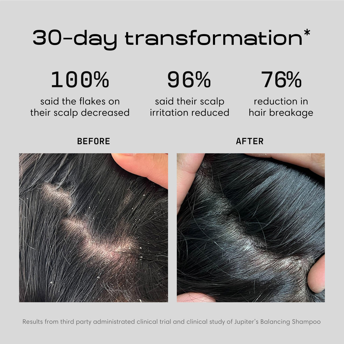 Jupiter Anti Dandruff Shampoo & Conditioner for Scalp Health - Color-Safe & Sulfate-Free